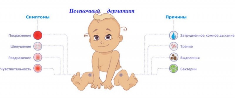 Симптомы пелёночного дерматита